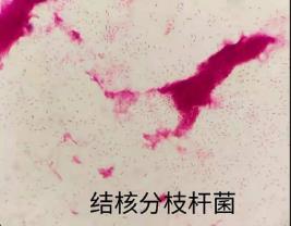 結核分枝桿菌的生物學特性、培養方法及應用