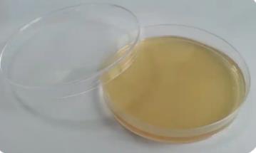 什么是不可培養(yǎng)微生物？原因是什么